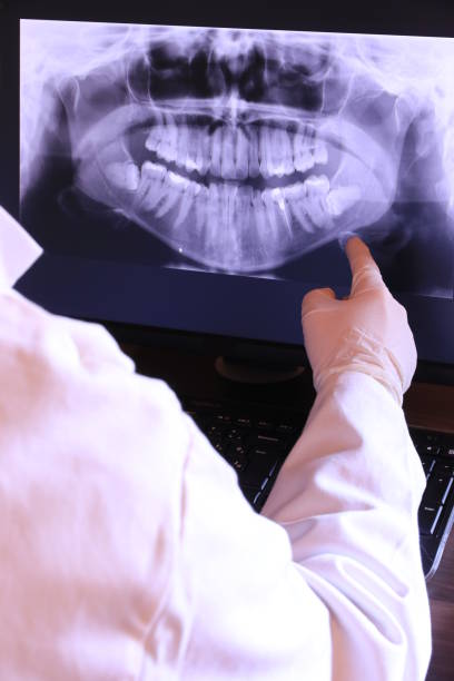 Best Emergency Dental Extractions in Jones, OK